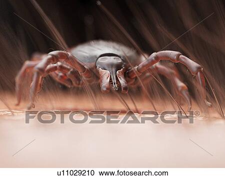 Stock Image - Illustration of a tick crawling on human skin. Fotosearch