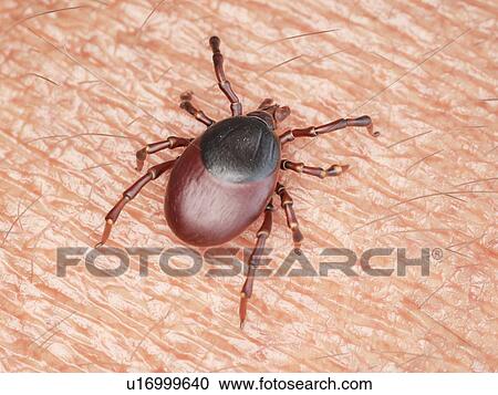 Illustration of a tick crawling on human skin View Large Photo Image Stock Image - Illustration of a tick crawling on human skin. Fotosearch