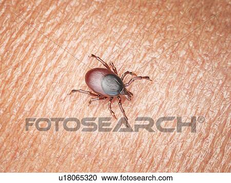 Illustration of a tick crawling on human skin View Large Photo Image Stock Image - Illustration of a tick crawling on human skin. Fotosearch