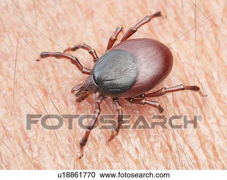 Illustration of a tick crawling on human skin View Large Photo Image Stock Image - Illustration of a tick crawling on human skin. Fotosearch