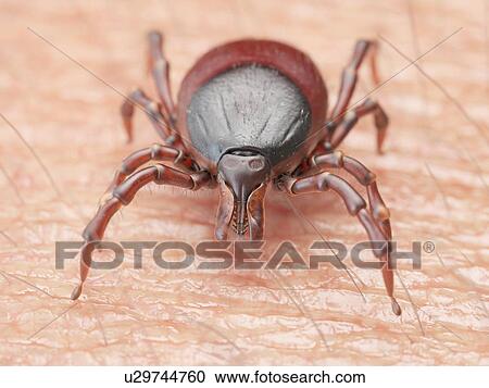 Illustration of a tick crawling on human skin View Large Photo Image Stock Image - Illustration of a tick crawling on human skin. Fotosearch