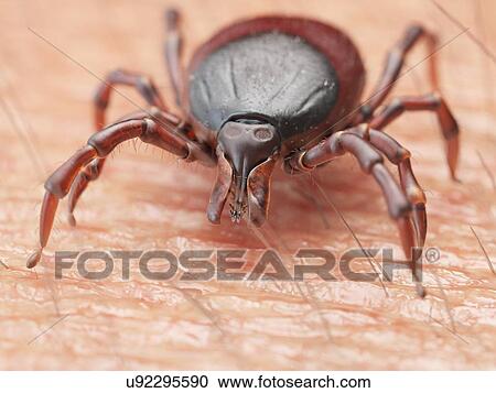 Illustration of a tick crawling on human skin View Large Photo Image Stock Image - Illustration of a tick crawling on human skin. Fotosearch