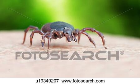 Illustration of a tick crawling on human skin View Large Photo Image Stock Photo - Illustration of a tick crawling on human skin. Fotosearch