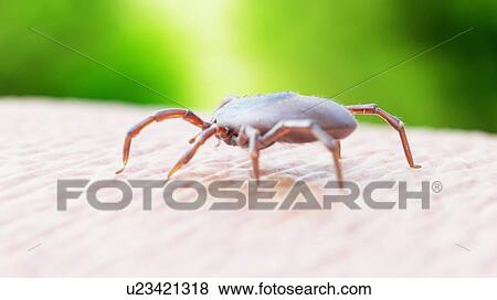 Illustration of a tick crawling on human skin View Large Photo Image Stock Photo - Illustration of a tick crawling on human skin. Fotosearch