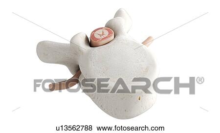 Illustration of a vertebra View Large Photo Image Stock Photo - Illustration of a vertebra. Fotosearch