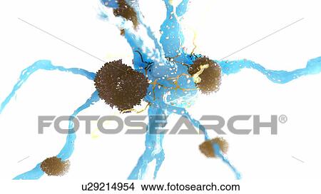 Picture - Illustration of Alzheimer's disease. Fotosearch