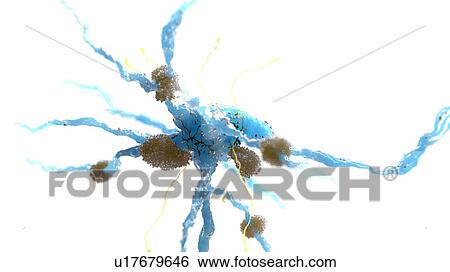 Stock Photograph - Illustration of Alzheimer's disease. Fotosearch