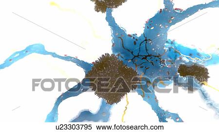 Stock Photography - Illustration of Alzheimer's disease. Fotosearch