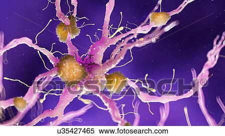 Illustration of Alzheimer's disease View Large Photo Image Stock Photography - Illustration of Alzheimer's disease. Fotosearch