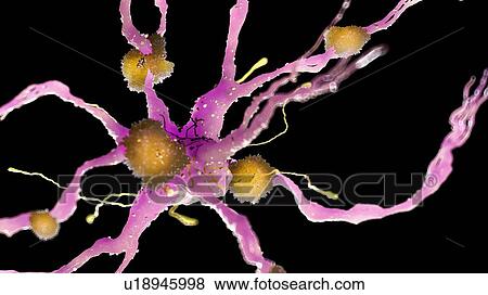 Stock Photo - Illustration of amyloid plaques on a nerve cell. Fotosearch