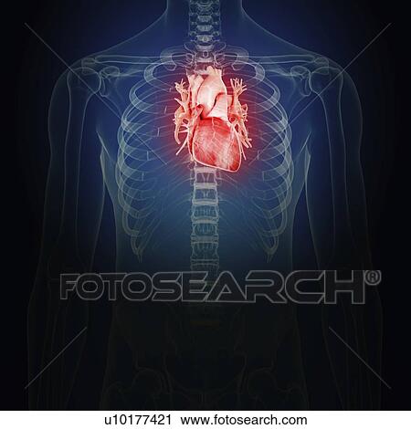 Illustration of an inflamed heart View Large Photo Image Stock Image - Illustration of an inflamed heart. Fotosearch