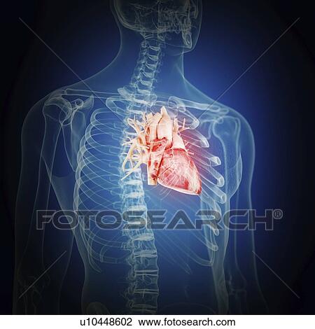 Stock Image - Illustration of an inflamed heart. Fotosearch