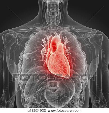 Illustration of an inflamed heart View Large Photo Image Stock Image - Illustration of an inflamed heart. Fotosearch