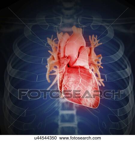 Stock Image - Illustration of an inflamed heart. Fotosearch