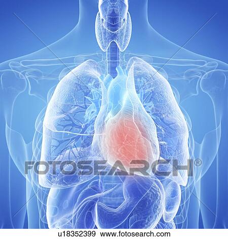 Illustration of an inflamed heart View Large Photo Image Stock Photo - Illustration of an inflamed heart. Fotosearch