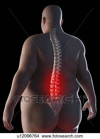 Picture - Illustration of an obese man having back pain. Fotosearch