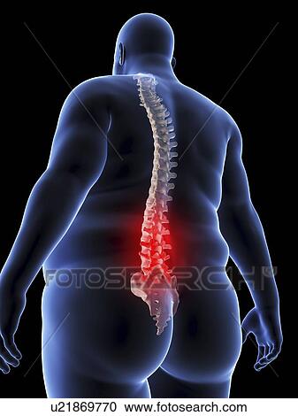 Illustration of an obese man having back pain View Large Photo Image Stock Image - Illustration of an obese man having back pain. Fotosearch