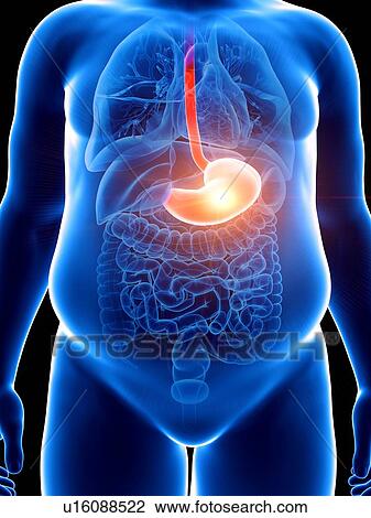 Stock Image - Illustration of an obese man with a painful stomach. Fotosearch