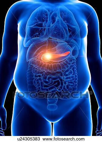 Stock Image - Illustration of an obese man with a painful pancreas. Fotosearch