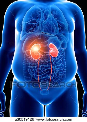 Illustration of an obese man with a painful kidney View Large Photo Image Stock Photograph - Illustration of an obese man with a painful kidney. Fotosearch