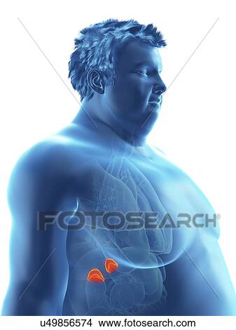 Picture - Illustration of an obese man's adrenal glands. Fotosearch