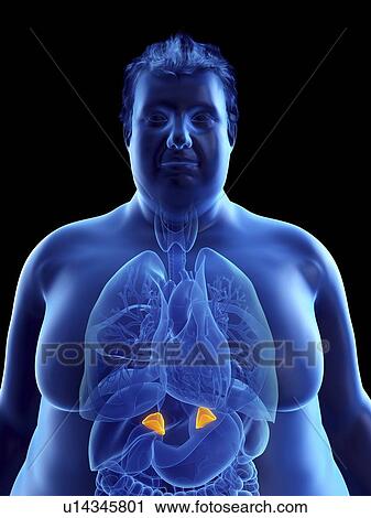 Illustration of an obese man's adrenal glands View Large Photo Image Stock Image - Illustration of an obese man's adrenal glands. Fotosearch