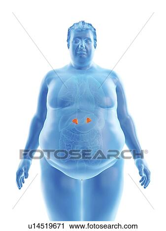 Illustration of an obese man's adrenal glands View Large Photo Image Stock Image - Illustration of an obese man's adrenal glands. Fotosearch