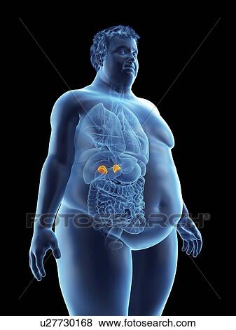 Stock Photo - Illustration of an obese man's adrenal glands. Fotosearch