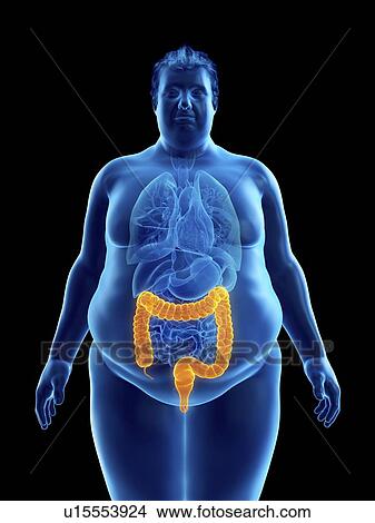 Illustration of an obese man's colon View Large Photo Image Picture - Illustration of an obese man's colon. Fotosearch