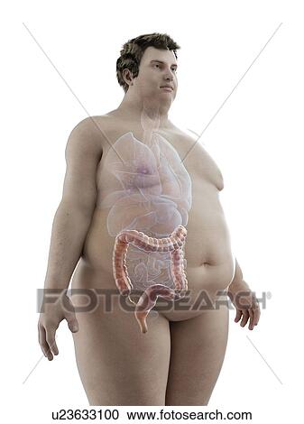 Illustration of an obese man's colon View Large Photo Image Stock Image - Illustration of an obese man's colon. Fotosearch