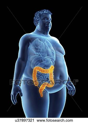 Stock Image - Illustration of an obese man's colon. Fotosearch