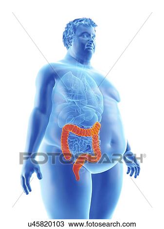Stock Image - Illustration of an obese man's colon. Fotosearch