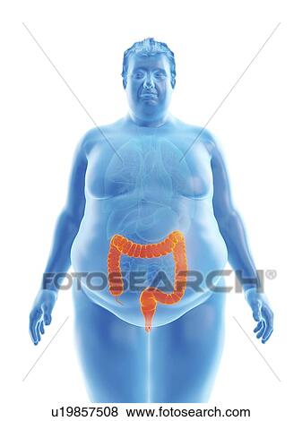 Illustration of an obese man's colon View Large Photo Image Stock Photo - Illustration of an obese man's colon. Fotosearch