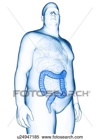 Stock Photography - Illustration of an obese man's colon. Fotosearch