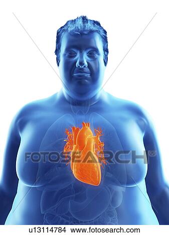 Picture - Illustration of an obese man's heart. Fotosearch