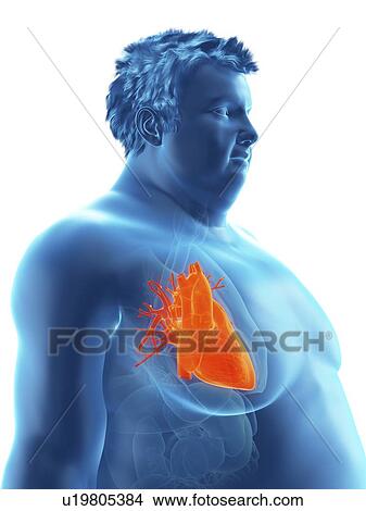 Illustration of an obese man's heart View Large Photo Image Picture - Illustration of an obese man's heart. Fotosearch