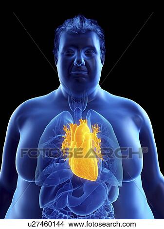 Illustration of an obese man's heart View Large Photo Image Picture - Illustration of an obese man's heart. Fotosearch