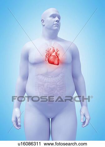 Illustration of an obese man's heart View Large Photo Image Stock Image - Illustration of an obese man's heart. Fotosearch