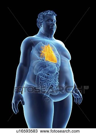 Illustration of an obese man's heart View Large Photo Image Stock Image - Illustration of an obese man's heart. Fotosearch