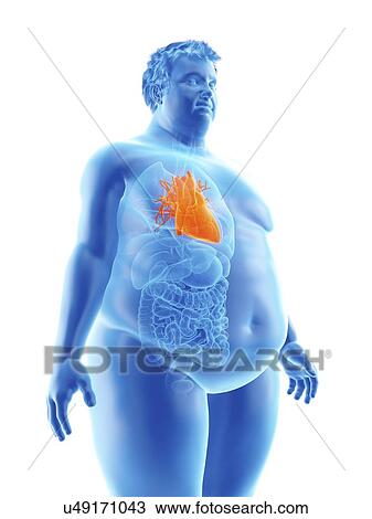 Illustration of an obese man's heart View Large Photo Image Stock Image - Illustration of an obese man's heart. Fotosearch