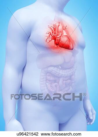 Illustration of an obese man's heart View Large Photo Image Stock Image - Illustration of an obese man's heart. Fotosearch