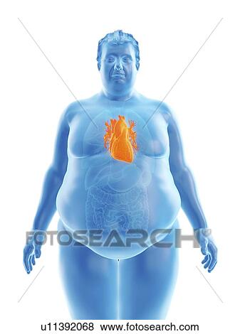 Illustration of an obese man's heart View Large Photo Image Stock Photo - Illustration of an obese man's heart. Fotosearch