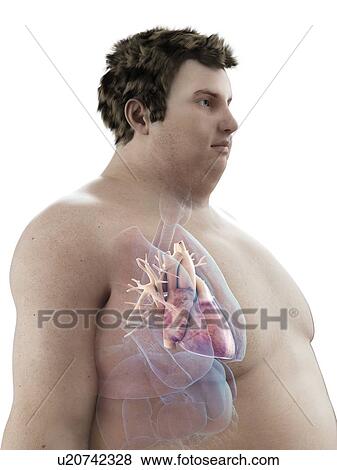Illustration of an obese man's heart View Large Photo Image Stock Photo - Illustration of an obese man's heart. Fotosearch