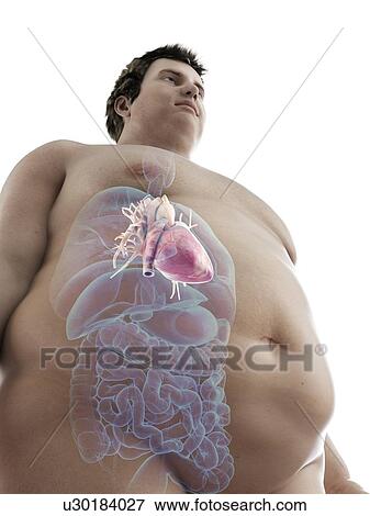 Illustration of an obese man's heart View Large Photo Image Stock Photo - Illustration of an obese man's heart. Fotosearch