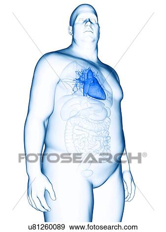 Illustration of an obese man's heart View Large Photo Image Stock Photo - Illustration of an obese man's heart. Fotosearch