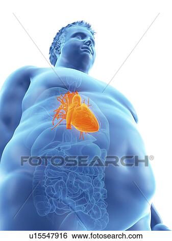 Illustration of an obese man's heart View Large Photo Image Stock Photograph - Illustration of an obese man's heart. Fotosearch