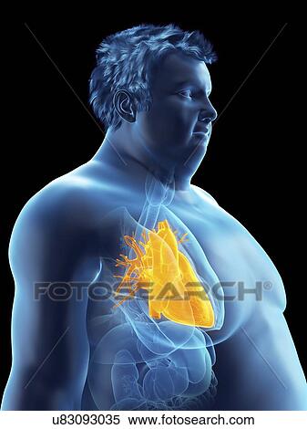 Illustration of an obese man's heart View Large Photo Image Stock Photography - Illustration of an obese man's heart. Fotosearch