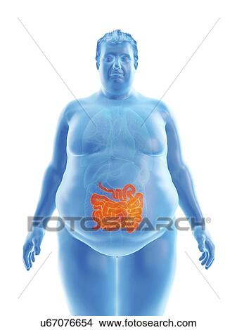 Illustration of an obese man's intestine View Large Photo Image Picture - Illustration of an obese man's intestine. Fotosearch