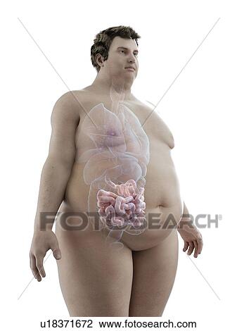 Illustration of an obese man's intestine View Large Photo Image Stock Image - Illustration of an obese man's intestine. Fotosearch