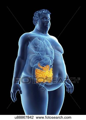 Stock Image - Illustration of an obese man's intestine. Fotosearch